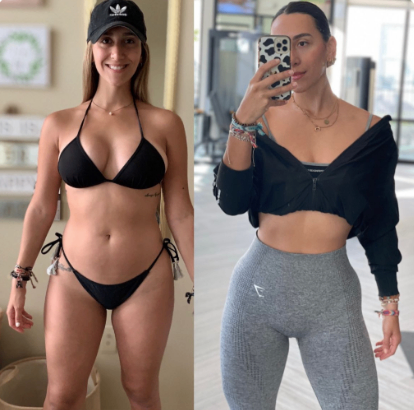 Abdomen plano y desinflamado
