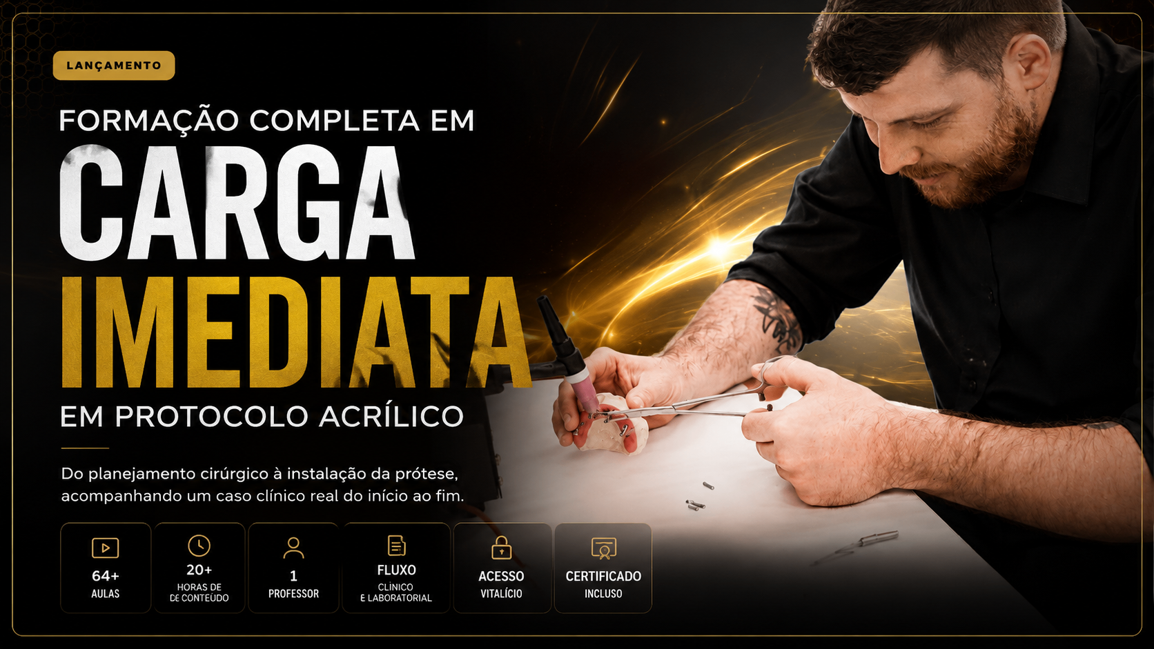 Carga Imediata em Protocolo Acrílico