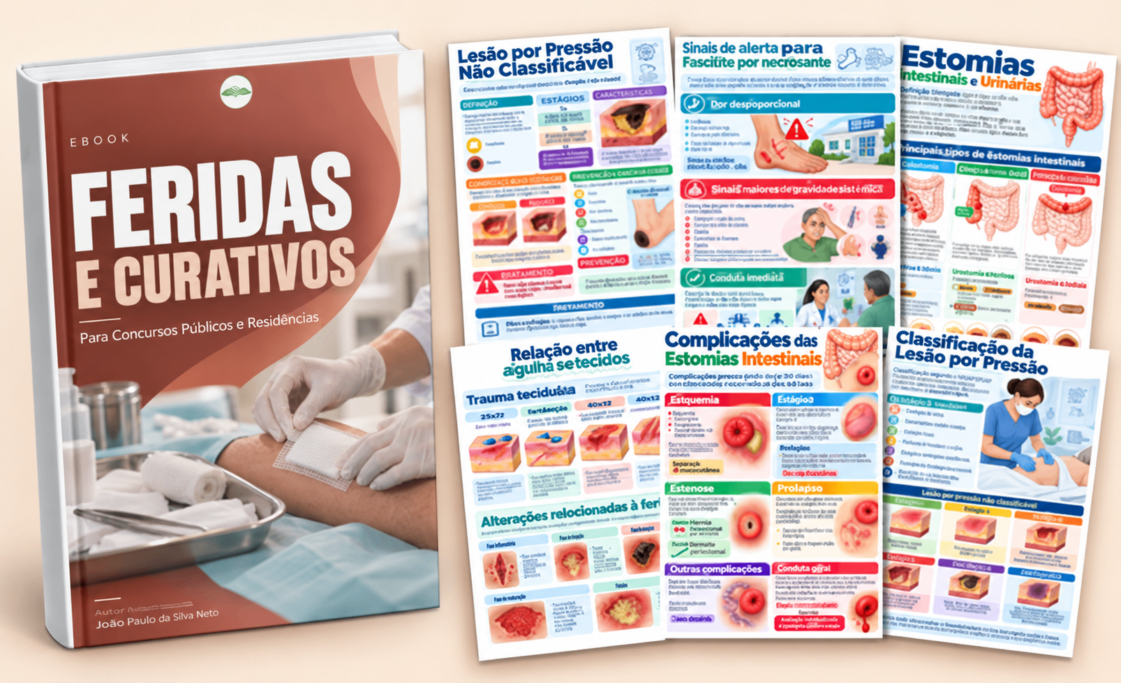 Capa do E-book Feridas e Curativos