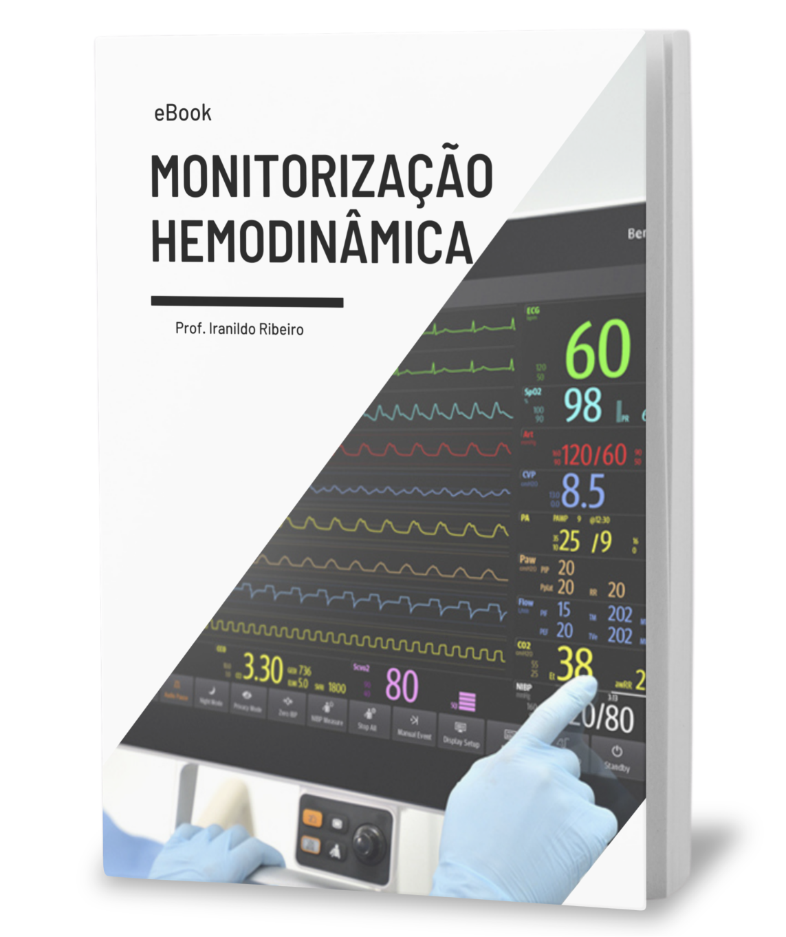 Monitorização Hemodinâmica